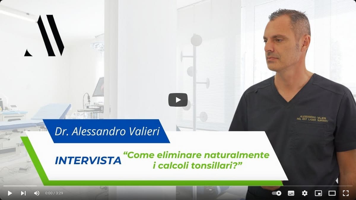 Come eliminare naturalmente calcoli tonsillari - video del Dr-Alessandro-Valieri